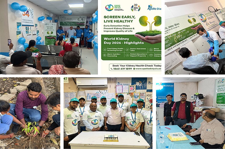 Patna wkd activities photo